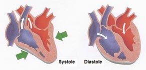 Systole